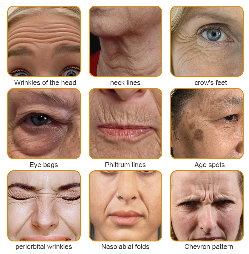BeeBotox Cream | Anti-Aging Cream with Bee Venom and Botox