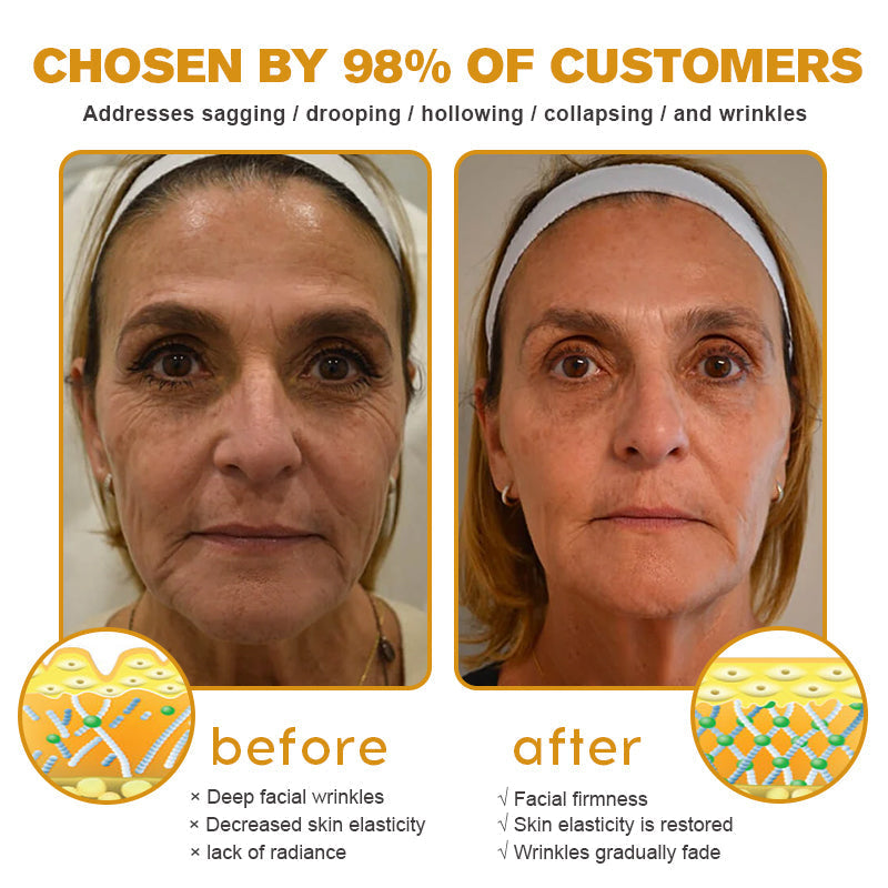 BeeBotox Cream | Anti-Aging Cream with Bee Venom and Botox