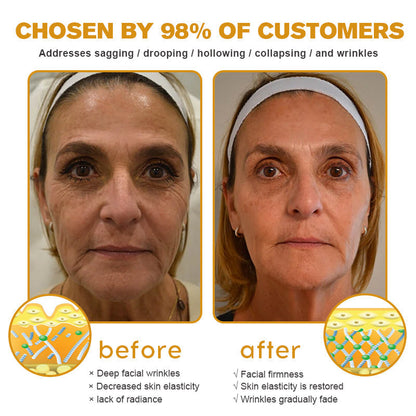BeeBotox Cream | Anti-Aging Cream with Bee Venom and Botox